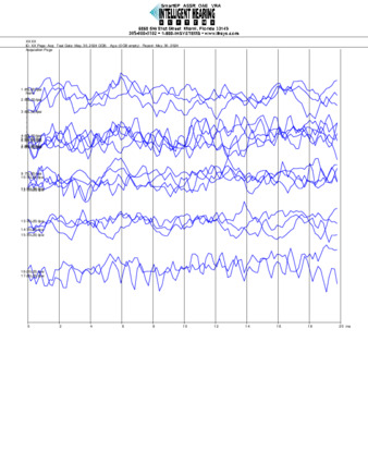 File thumbnail: Nanichi_2000_parietal_threshold.pdf