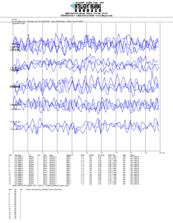 File thumbnail: Loiza_250_parietal_threshold.pdf