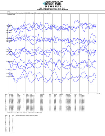 File thumbnail: Dakiti_2000_parietal_threshold.pdf