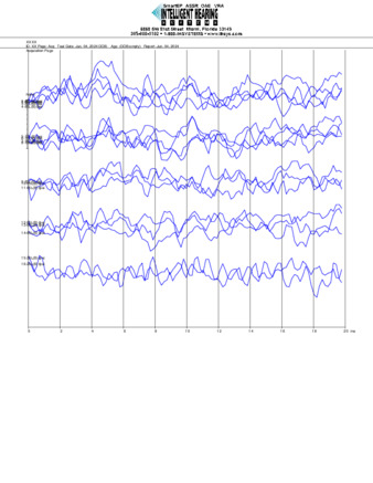 File thumbnail: Loiza_6000_parietal_threshold.pdf