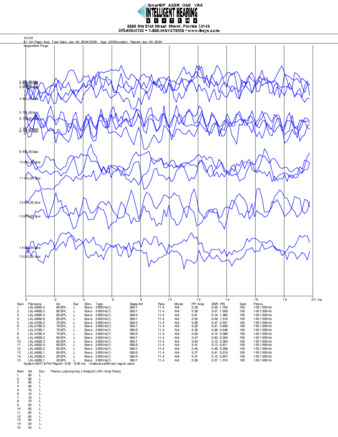 File thumbnail: Loiza_2000_parietal_threshold.pdf