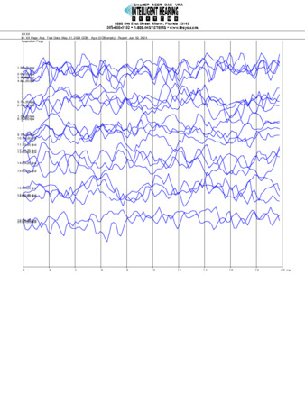 File thumbnail: Tai_2000_parietal_threshold.pdf