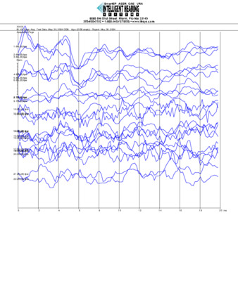 File thumbnail: Nanichi_8000_parietal_threshold.pdf