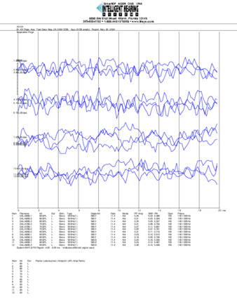 File thumbnail: Dakiti_500_parietal_threshold.pdf