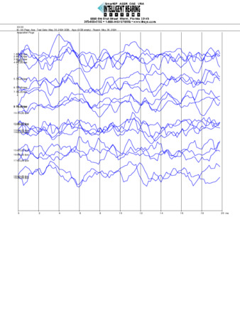 File thumbnail: Nanichi_6000_parietal_threshold.pdf