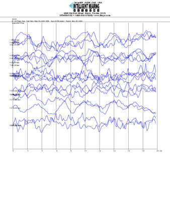 File thumbnail: Nanichi_250_parietal_threshold.pdf