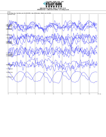 File thumbnail: Bajari_2000_Parietal_threshold.pdf