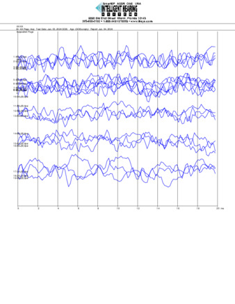 File thumbnail: Bajari_250_parietal_threshold.pdf