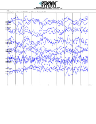 File thumbnail: Loiza_8000_parietal_threshold.pdf