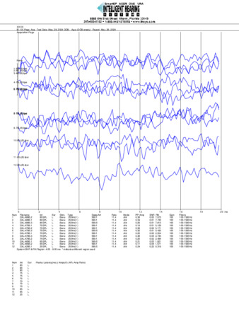 File thumbnail: Dakiti_250_parietal_threshold.pdf