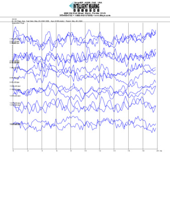 File thumbnail: Dakiti_6000_parietal_threshold.pdf