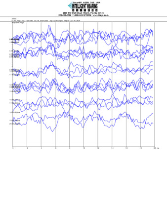 File thumbnail: Bajari_8000_parietal_threshold.pdf