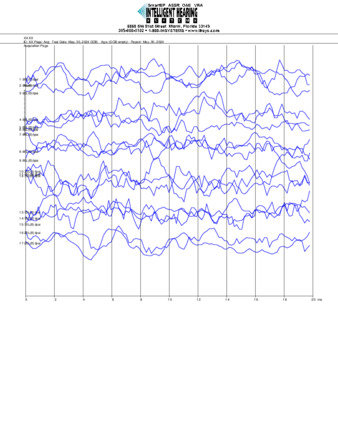 File thumbnail: Nanichi_500_parietal_threshold.pdf