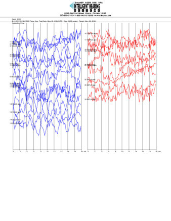 File thumbnail: dakita_air_conduction_8000hz__threshold_l_and_r.pdf