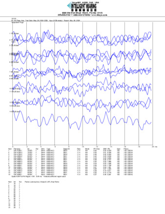 File thumbnail: Dakiti_8000_parietal_threshold.pdf