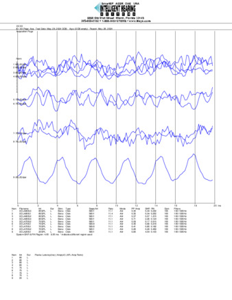 File thumbnail: Dakiti_click_parietal_threshold.pdf