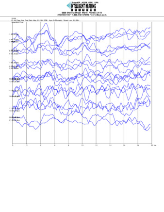 File thumbnail: Tai_6000_parietal_threshold.pdf