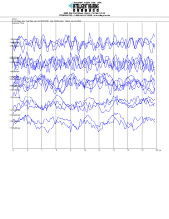 File thumbnail: Bajari_500_parietal_threshold.pdf