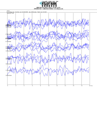File thumbnail: Bajari_6000_parietal_threshold.pdf